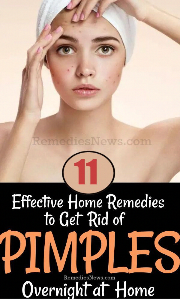 11 Effective Home Remedies to Get Rid of Pimples Overnight # ...