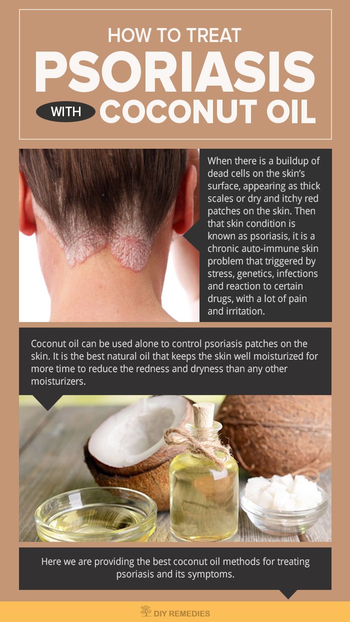 25 Benefits of Coconut Oil