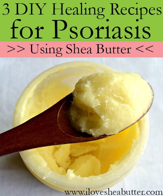 3 DIY Shea Butter Recipes for Psoriasis