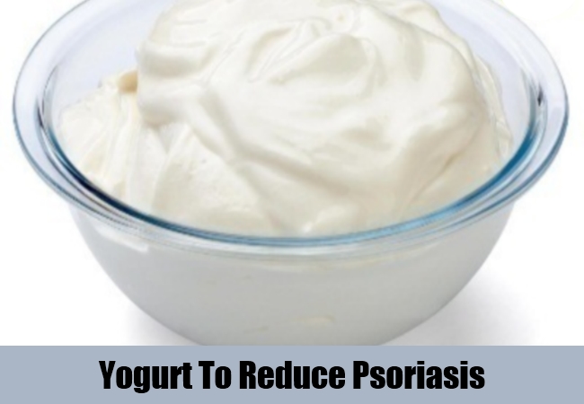 5 Best And Effective Methods To Cure Psoriasis Naturally ...