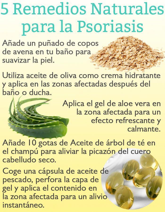 5 Remedios Naturales para la Psoriasis #plaquepsoriasistreatment ...
