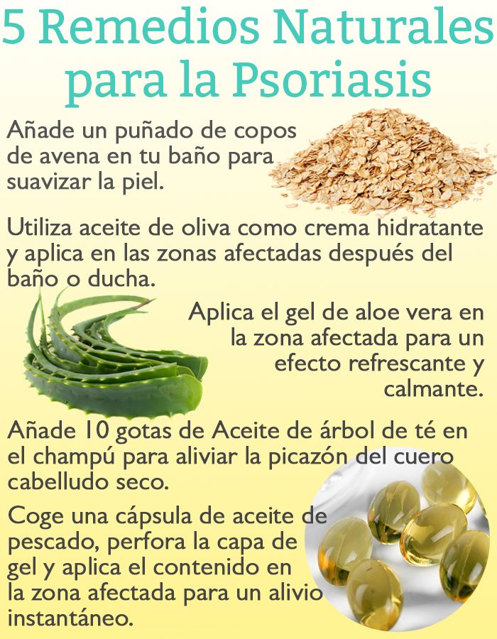 5 Remedios Naturales para la Psoriasis