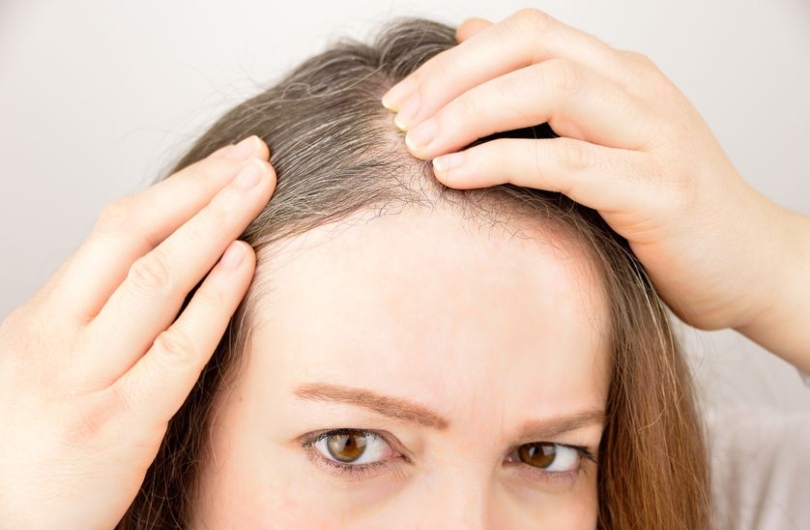 7 Best Shampoos For You Peeps With Scalp Psoriasis Problem ...
