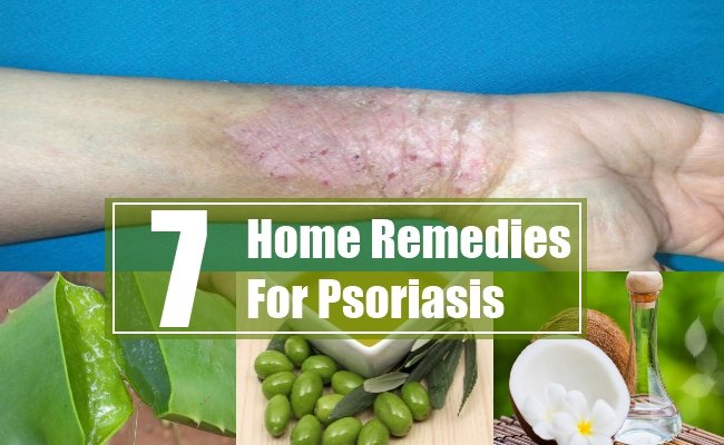 7 Home Remedies For Psoriasis
