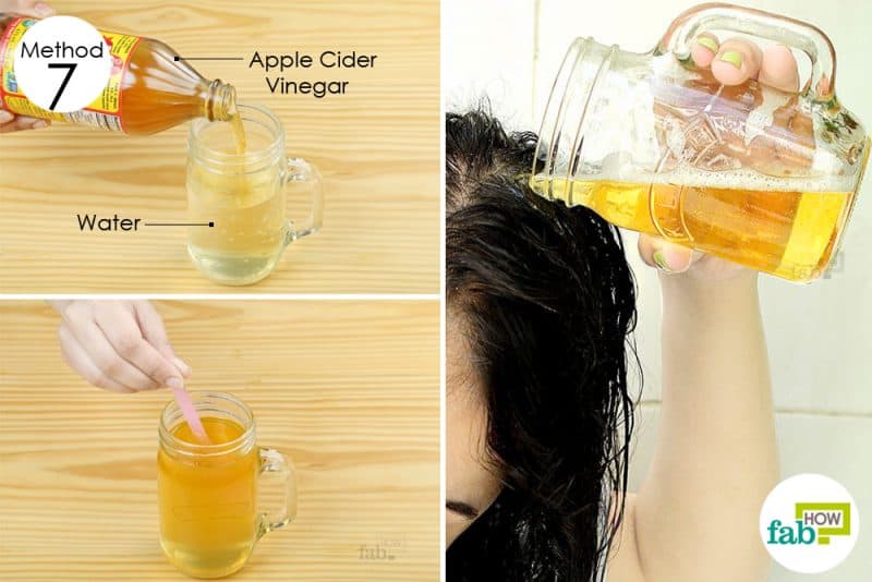 8 Best Home Remedies for Dry, Flaky Scalp That Work