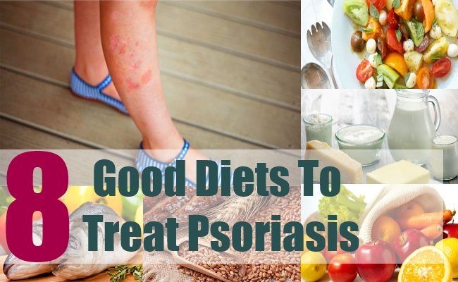 8 Good Diets To Treat Psoriasis