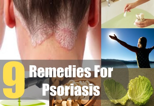 9 Ways To Treat Psoriasis