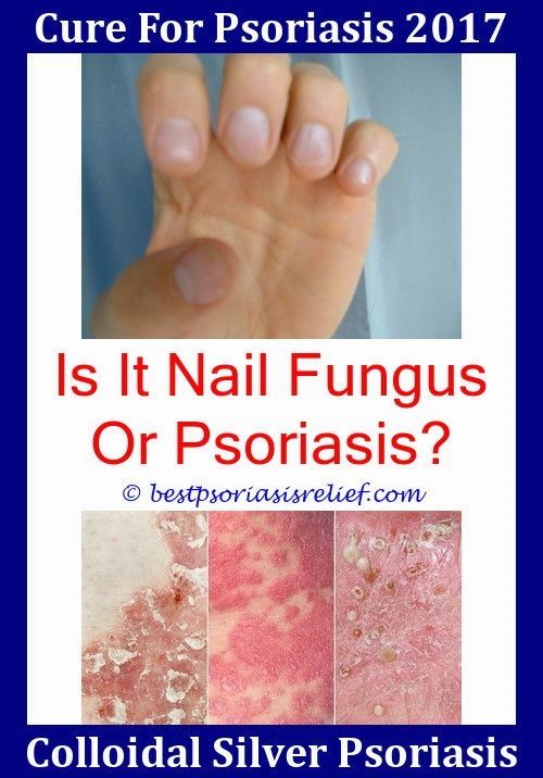 Adalimumab Psoriasis Side Effects,#natural #remedies for ...