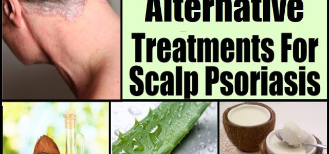 Alternative Treatment For Scalp Psoriasis