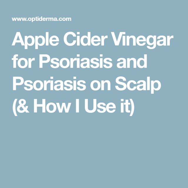 Apple Cider Vinegar for Psoriasis and Psoriasis on Scalp ...