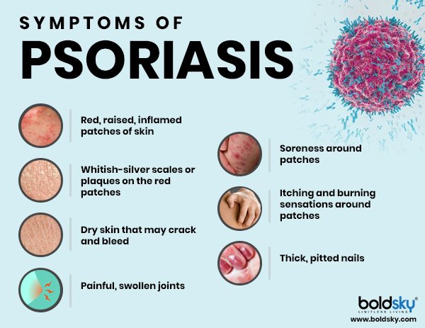 Biologics: What Are They &  How They Help Treat Psoriasis