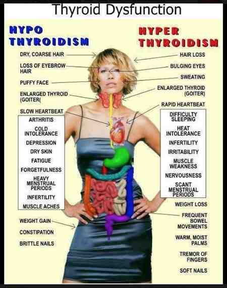 Bipolar Disorder and Thyroid Disease