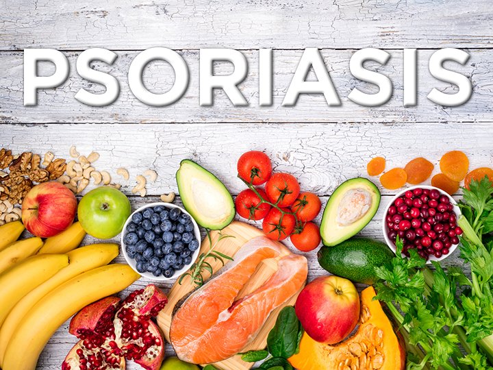 Can Diet Help in Psoriasis?