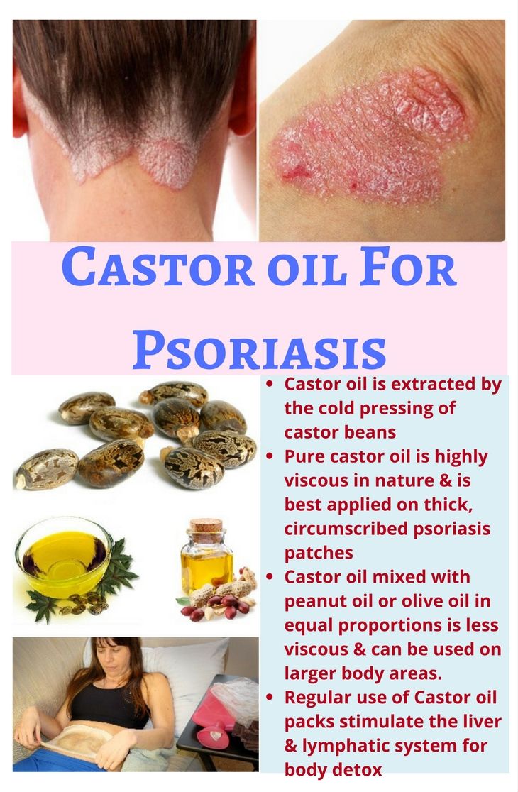 Castor oil alone or mixed with peanut oil/ olive oil is a ...