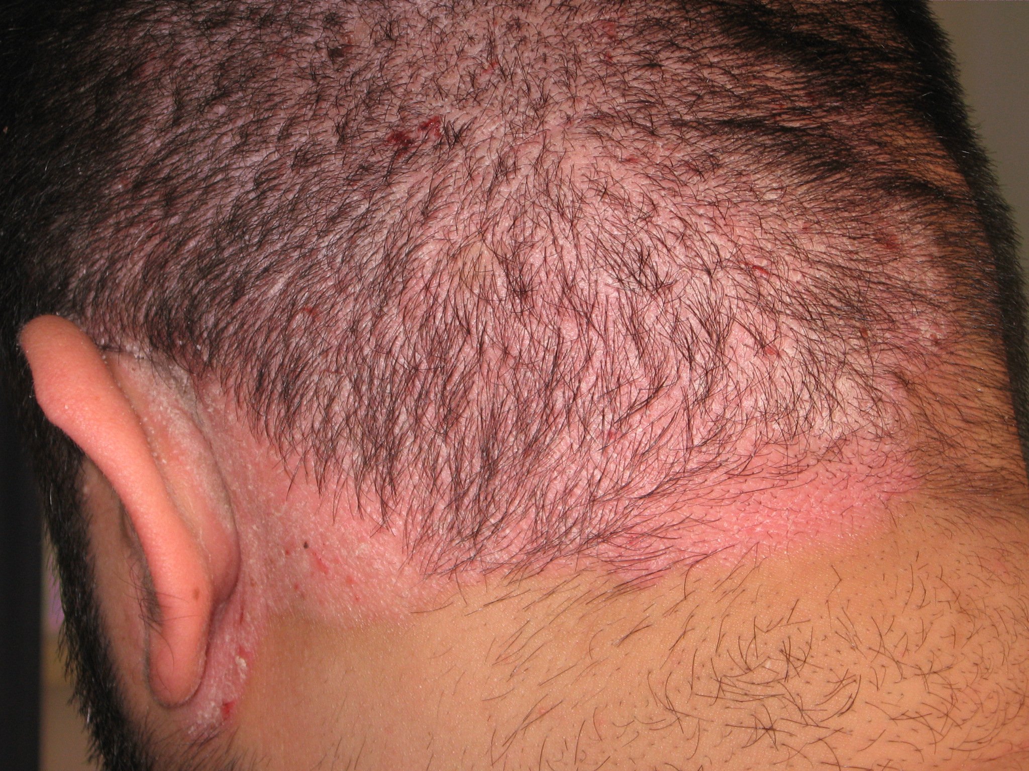 causes itchy scalp