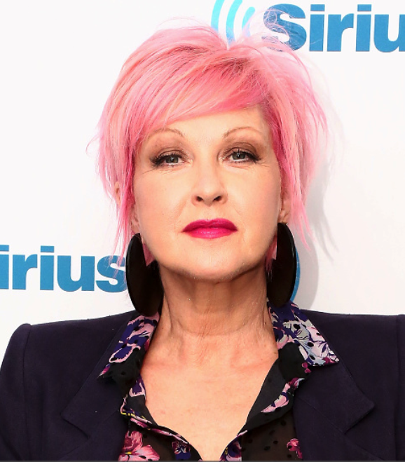 Cyndi Lauper Started Wearing Gloves To Hide Her Psoriasis