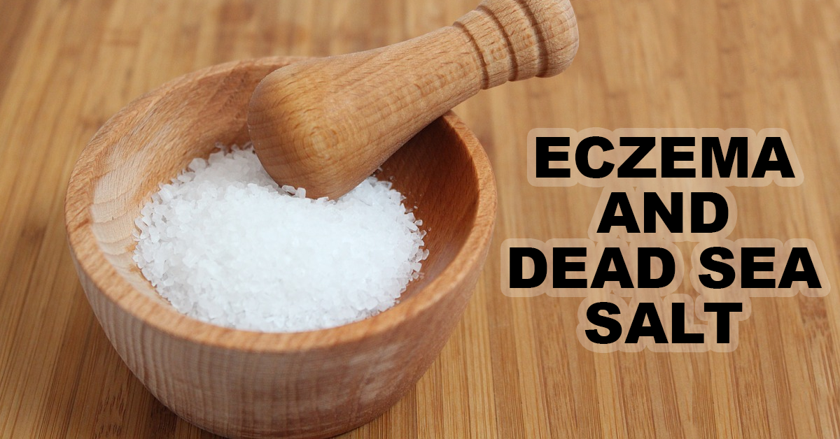 Dead sea salt and Eczema