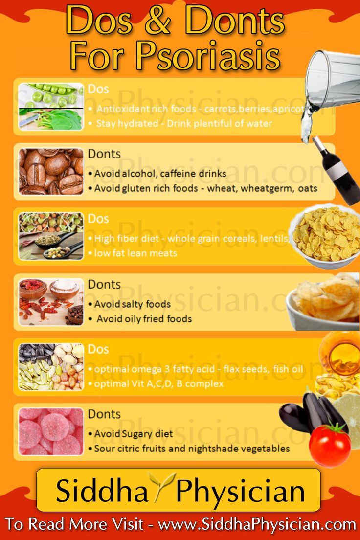 Dietary Dos &  Donts For Psoriasis. Find more at ...