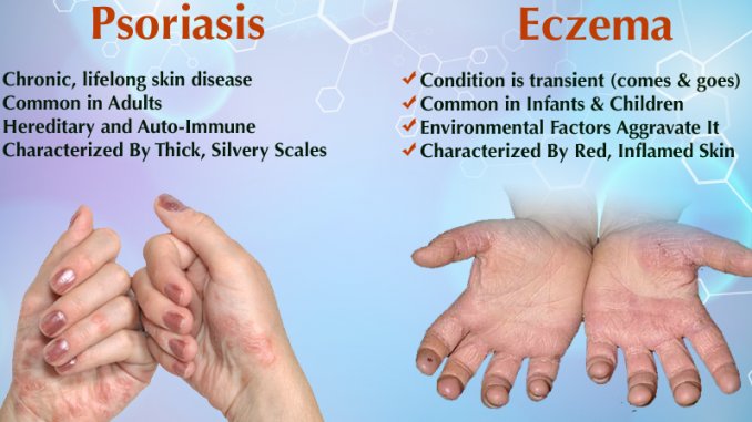 difference psoriasis and Eczema