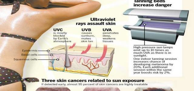 Do Tanning Beds Help With Psoriasis