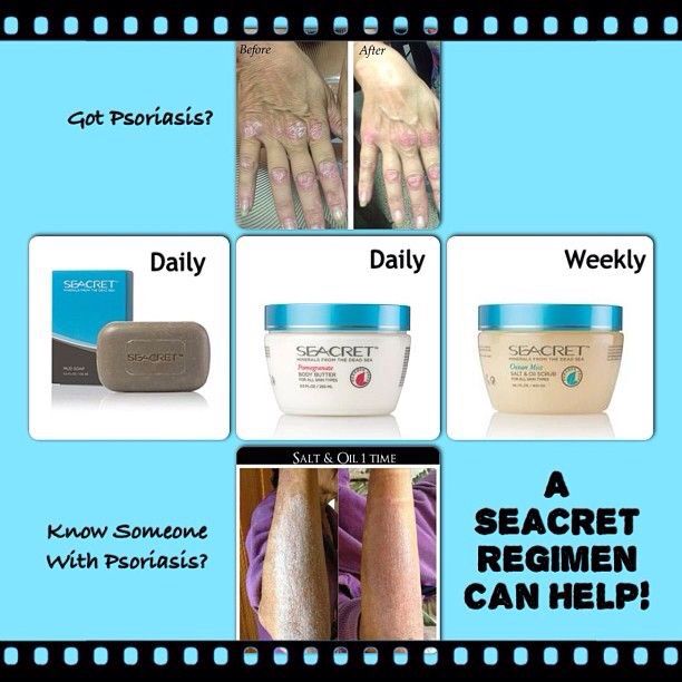 Do you know someone with Psoriasis? Seacret can help ...