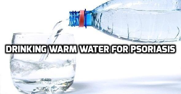 Drinking warm water is good for Psoriasis