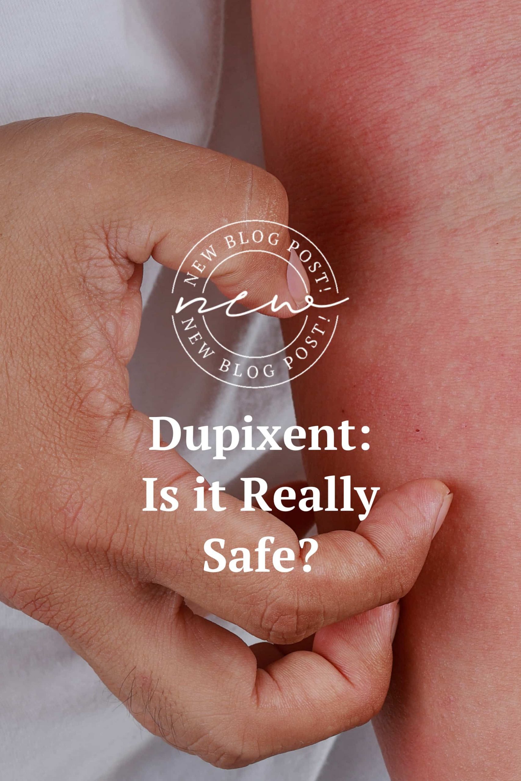 Dupixent: Is It Really the Best Way to Ease Eczema? in ...