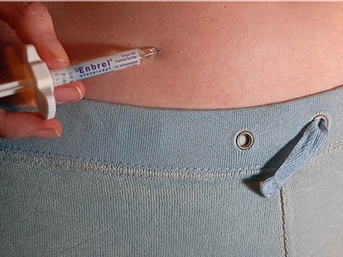 Enbrel Injection Uses, Dosage, Side Effects, Precautions