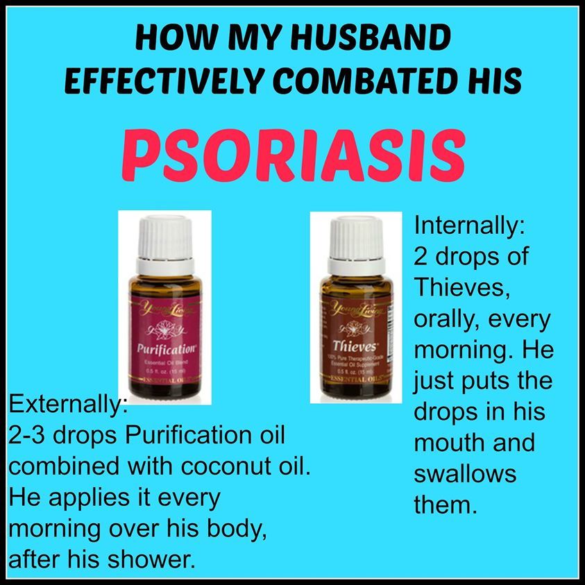 Essential oils for psoriasis, Essential oils health, Essential oil recipes