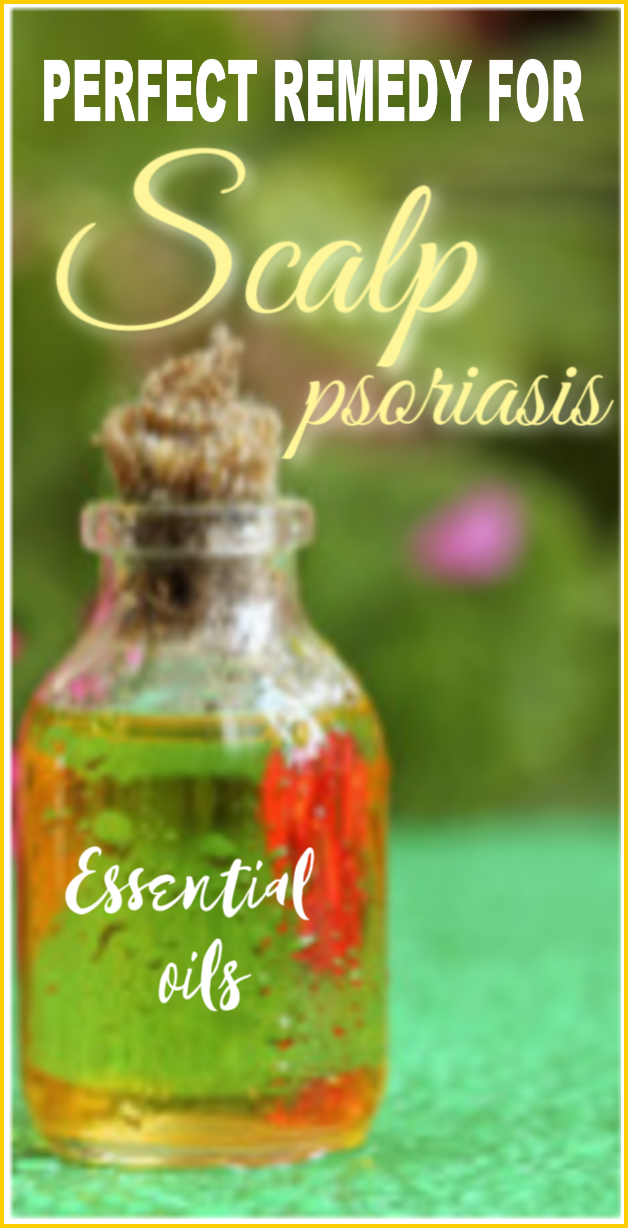 Essential Oils For Psoriasis Of Scalp #scalp # ...