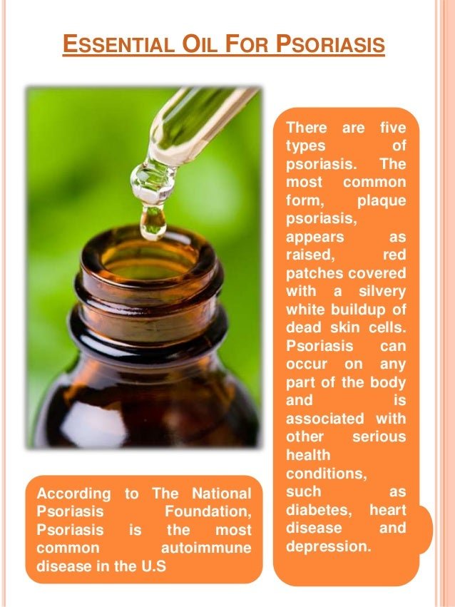 Essential oils for psoriasis