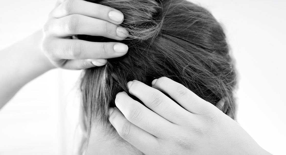 Hair Loss and Scalp Psoriasis How to cope with this condition ...