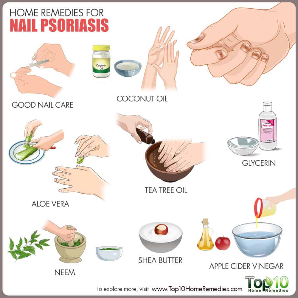 Home Remedies for Nail Psoriasis