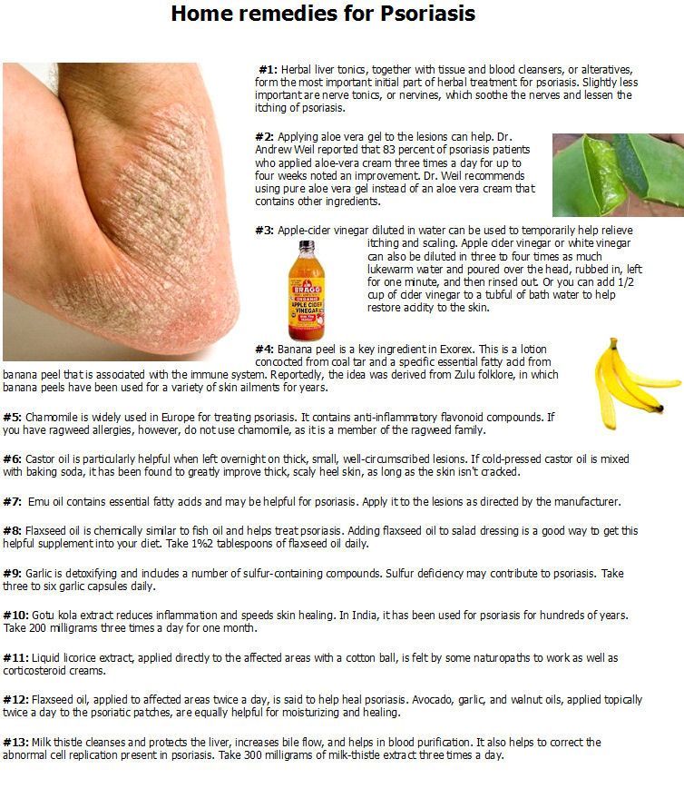 HOME REMEDIES FOR PSORIASIS