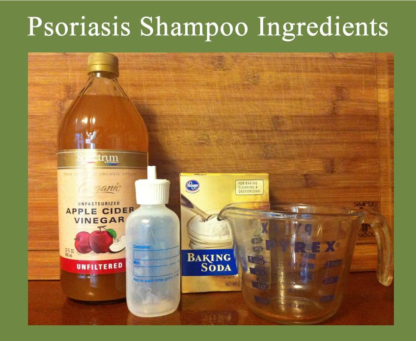 Homemade Natural Psoriasis Shampoo