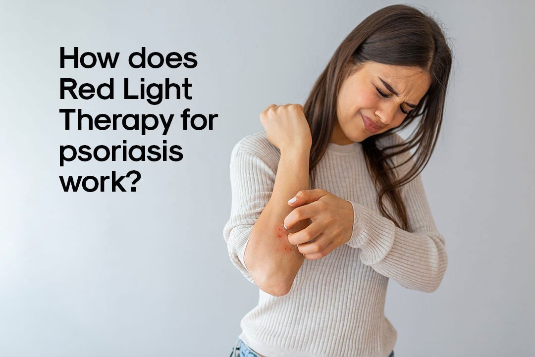 How Does Red Light Therapy For Psoriasis Work?