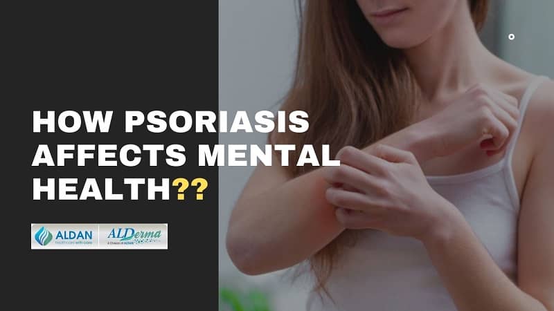 How Psoriasis Affects Mental Health