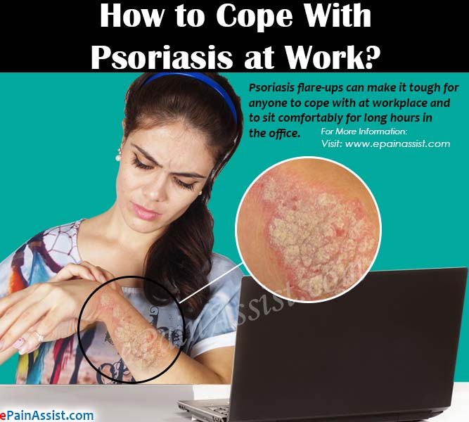How to Cope With Psoriasis at Work?
