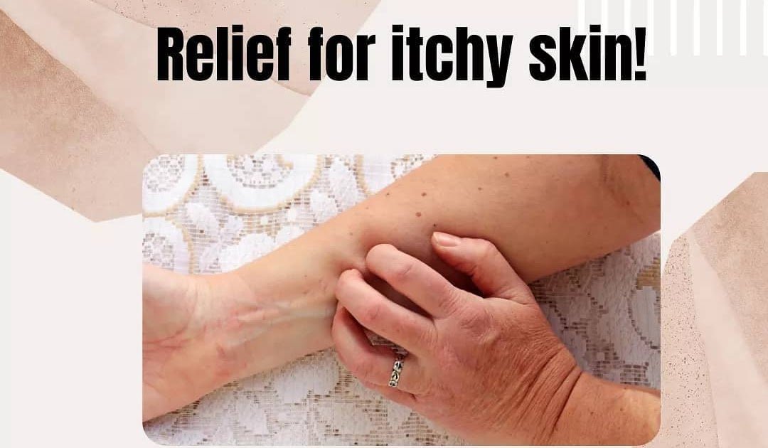 How To Cure Eczema Permanently: How to Stop Itching ...