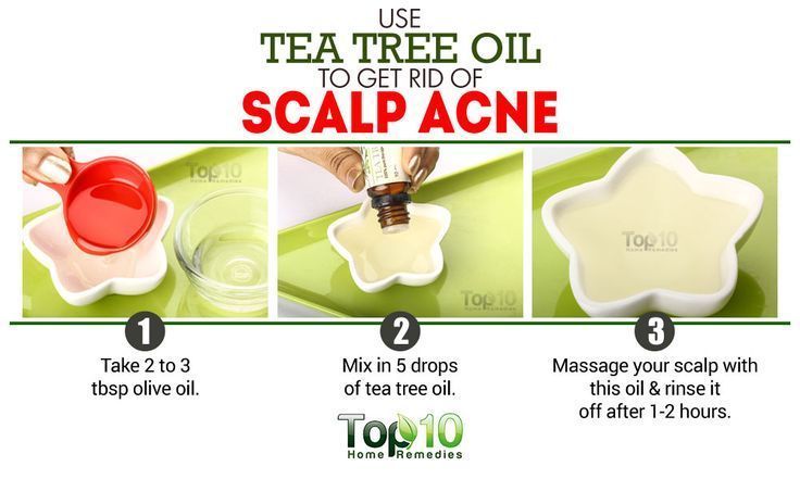 How to Get Rid of Scalp Acne