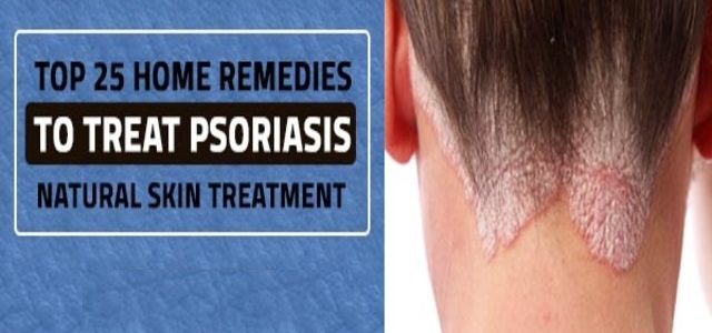 How To Get Rid Of Scalp Psoriasis Fast