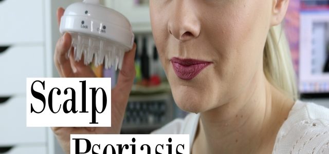 How To Get Rid Of Scalp Psoriasis Permanently