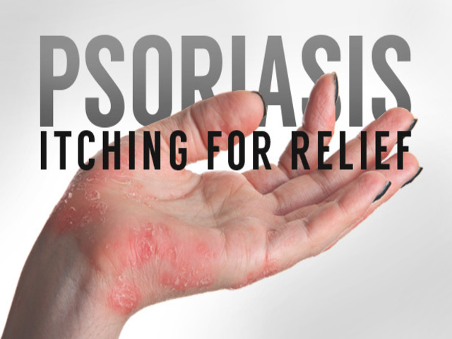 How To Help Psoriasis Itching
