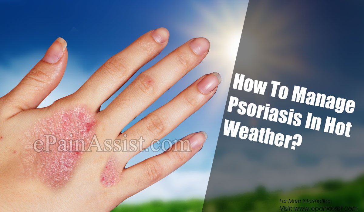 How To Manage Psoriasis In Hot Weather?