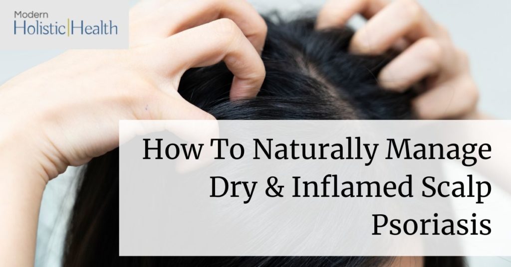 How To Naturally Manage Dry &  Inflamed Scalp Psoriasis ...