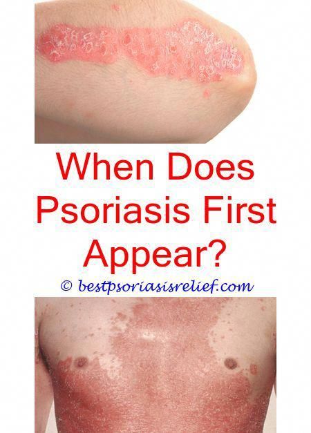 humirapsoriasis best treatment for psoriasis on face ...