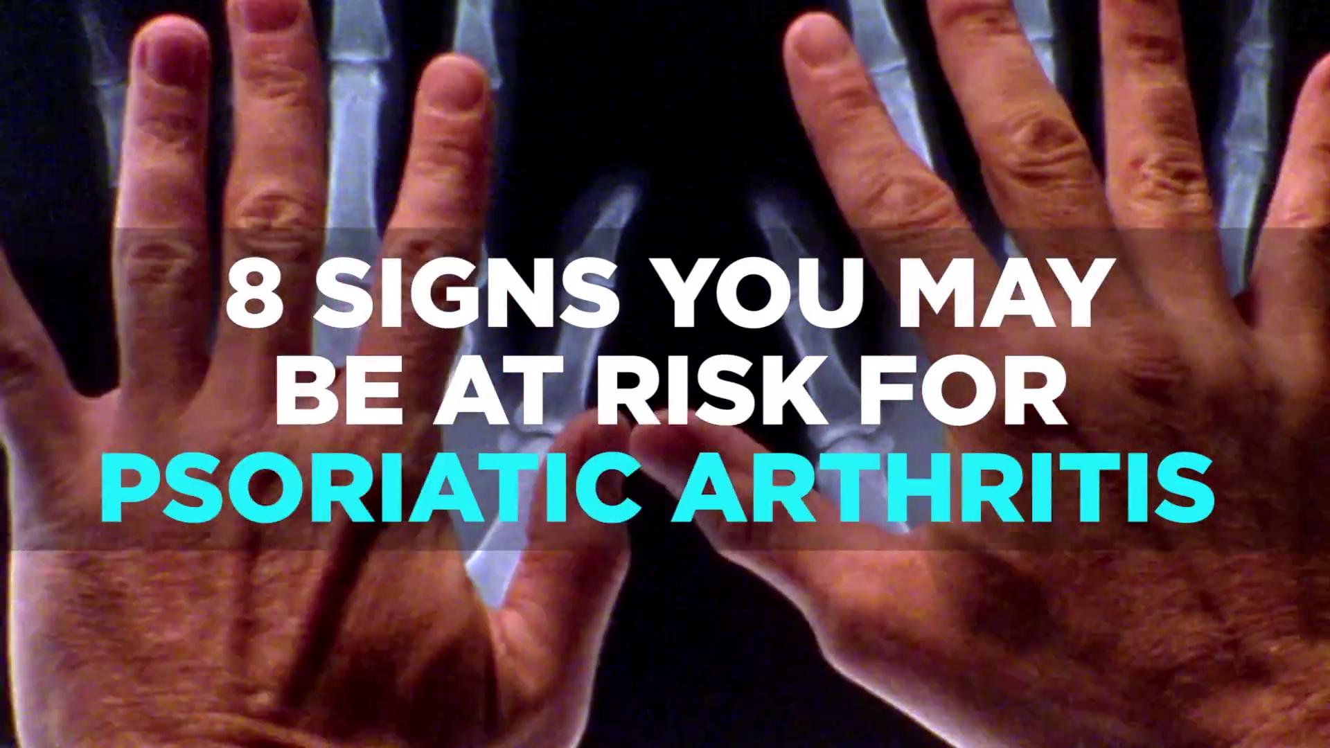 Is It Possible to Have Psoriatic Arthritis Without ...