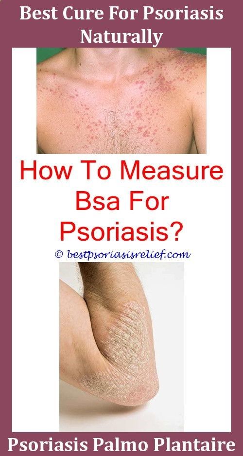 Kimkardashianpsoriasis Psoriasis On My Neck Thyme Out For Psoriasis How ...
