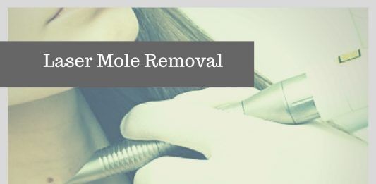 Laser Mole Removal: Benefits, Cost, and Procedure