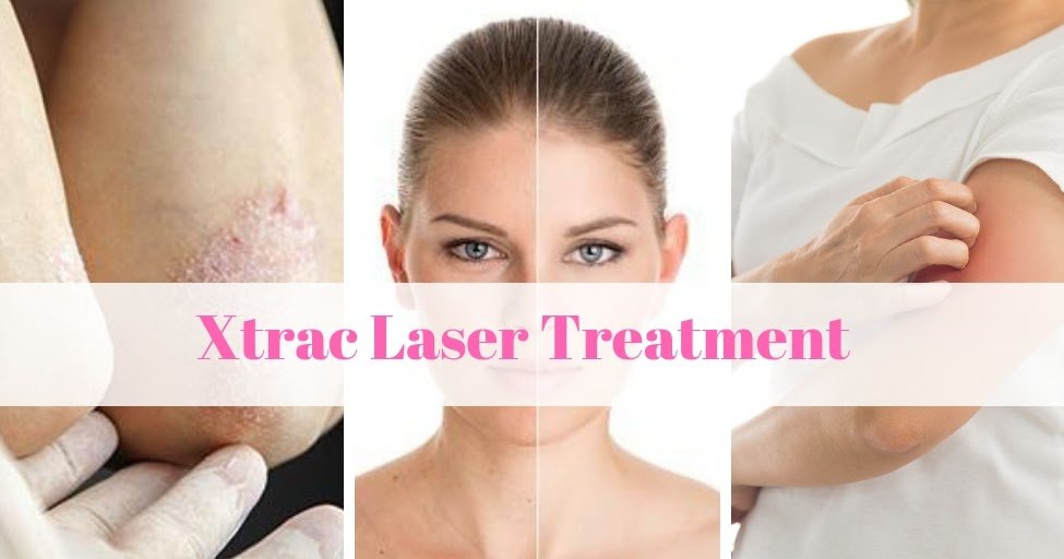 Love Your Skin: What benefits can expect from Xtrac Laser ...